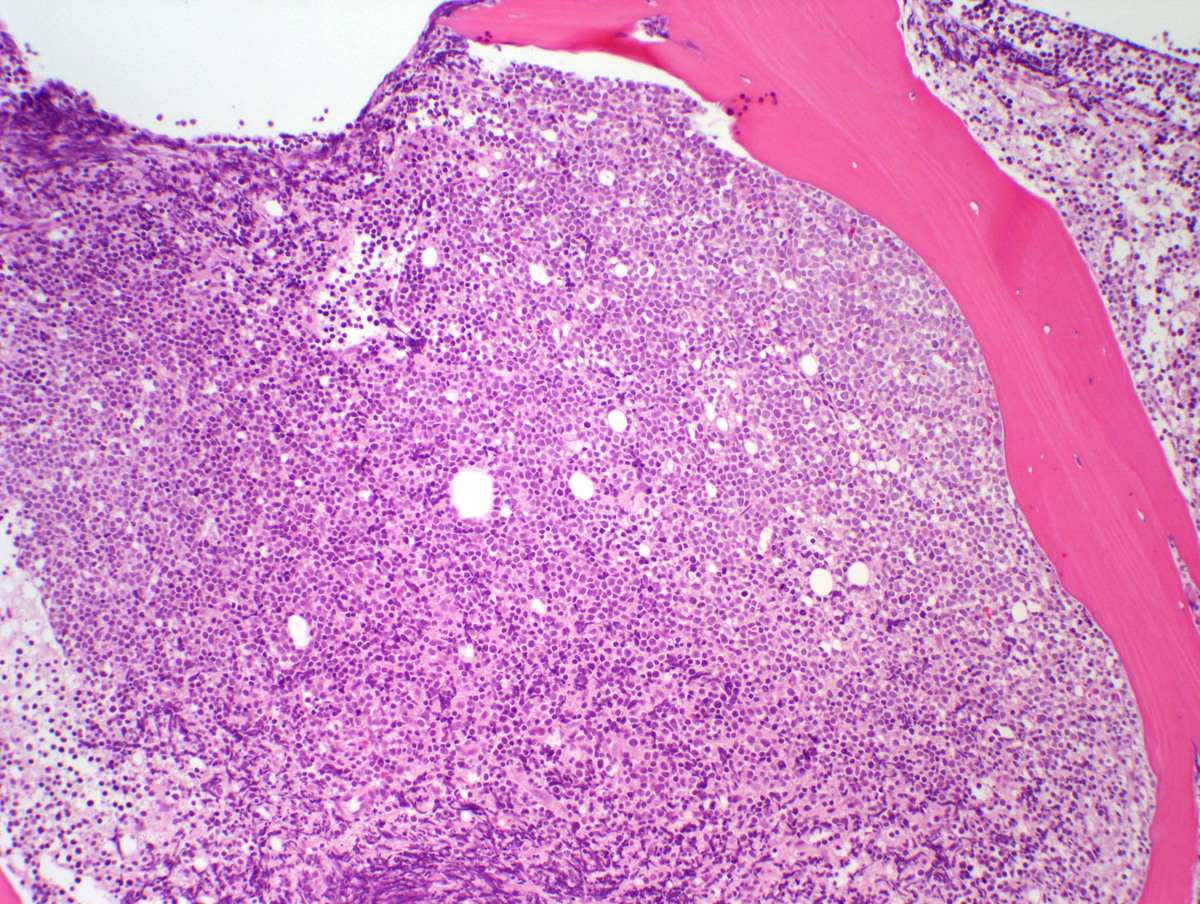 Bone Marrow core 100x